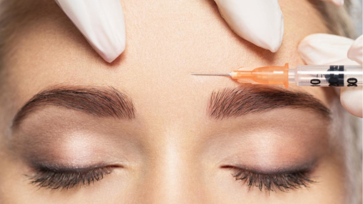 botox-18
